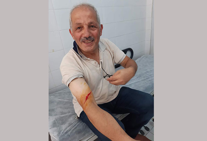 Trabzon’da Belediye Başkanı kurban kesiminde yaralandı