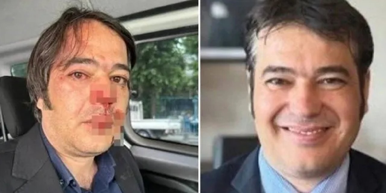 Tutuklu İBB İmar Daire Başkanı Gülten: Saldıranlar serbest, biz Silivri’deyiz