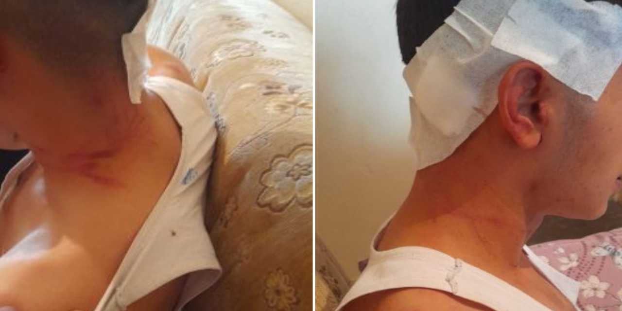 İddia: MHP'li belediye başkanının oğulları bir kişiyi darbetti