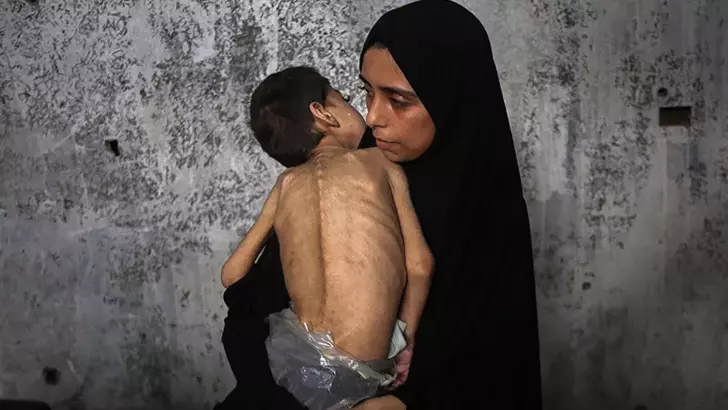 Gazze'de 5 aylık bebek açlıktan öldü