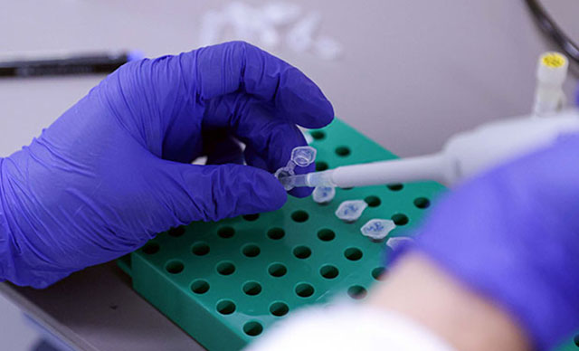 PCR zorunluluğu sonrası laboratuvarlardaki numune sayıları 2 kat arttı
