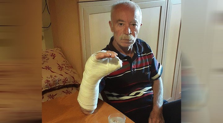 Kızılay'da polisi uyaran 64 yaşındaki vatandaşın kolu kırıldı