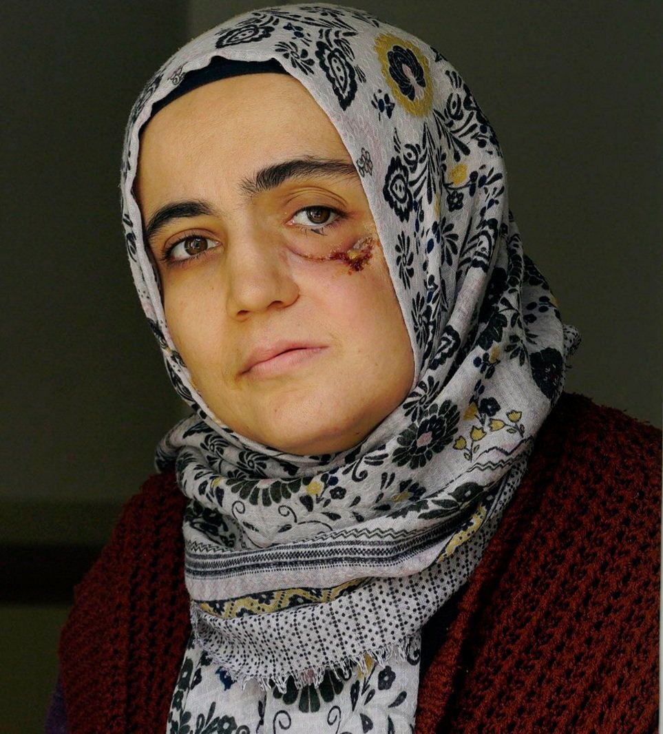 Kanser hastası hükümlü Ayşe Özdoğan’ın cezasının infazı 3 ay ertelendi