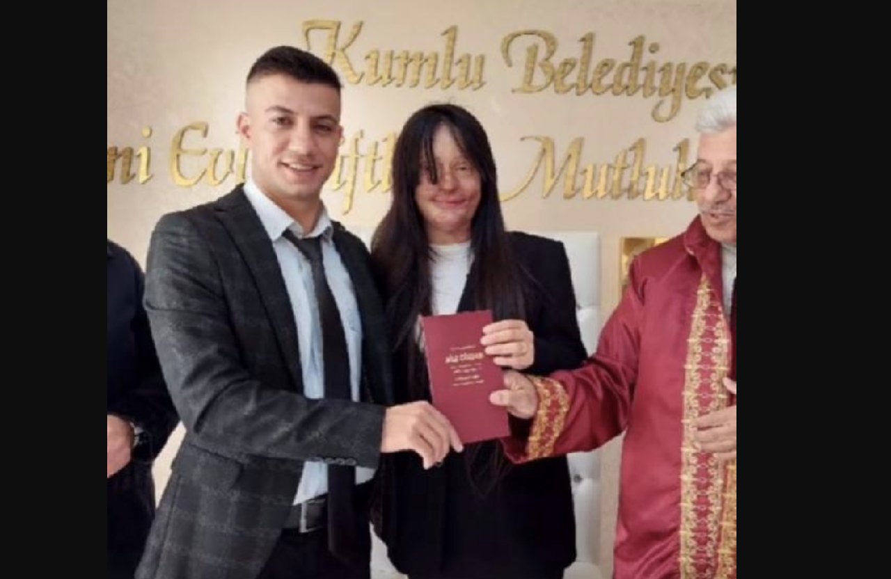 Berfin Özek, yüzüne kezzap atan eski erkek arkadaşıyla evlendi
