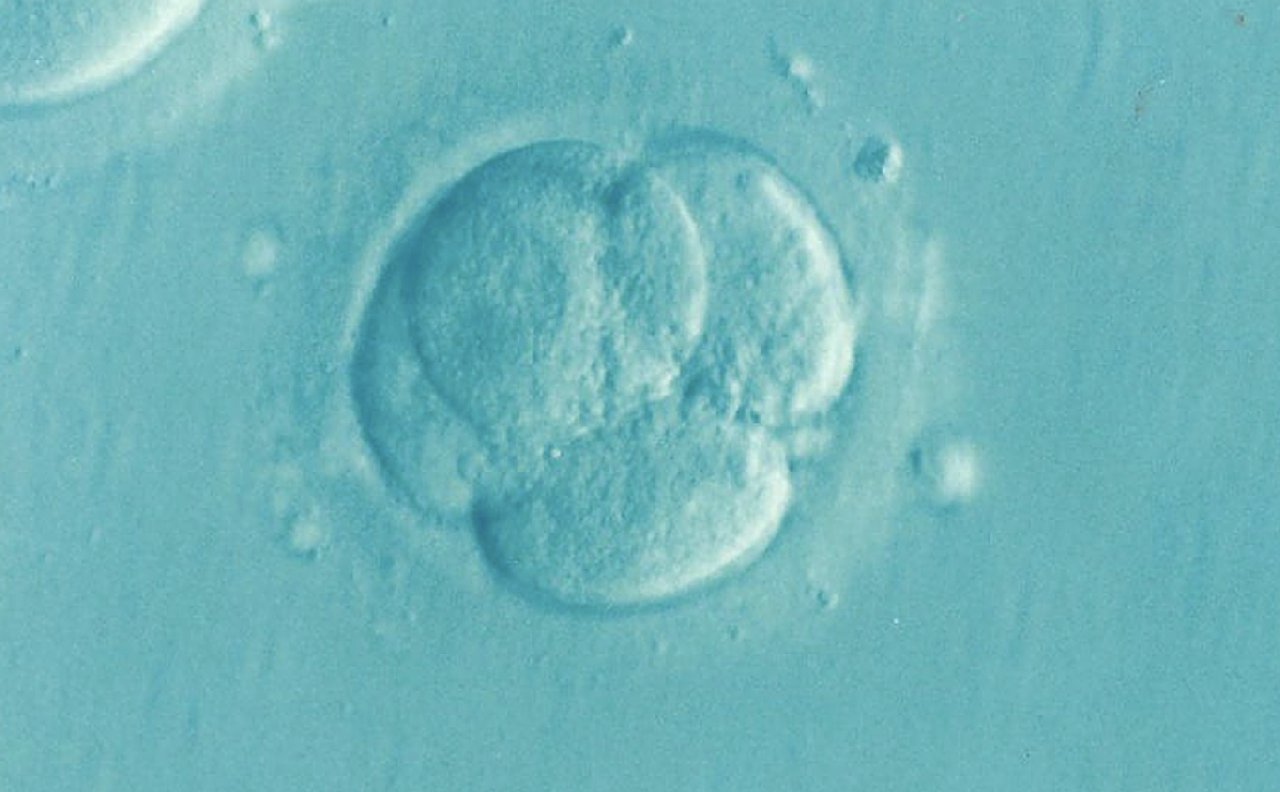 Hollanda'da doğurganlık tedavisinde kendi spermlerini kullanan doktor, en az 21 çocuğun babası çıktı