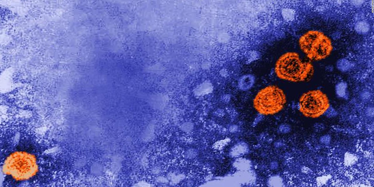 DSÖ'den 'gizemli hepatit' açıklaması: Aşıyla ilgisi yok