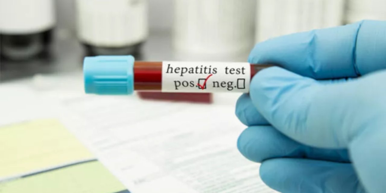 Prof. Dr. Ceyhan: 'Gizemli hepatit'te Covid-19 gibi yayılma beklemiyoruz