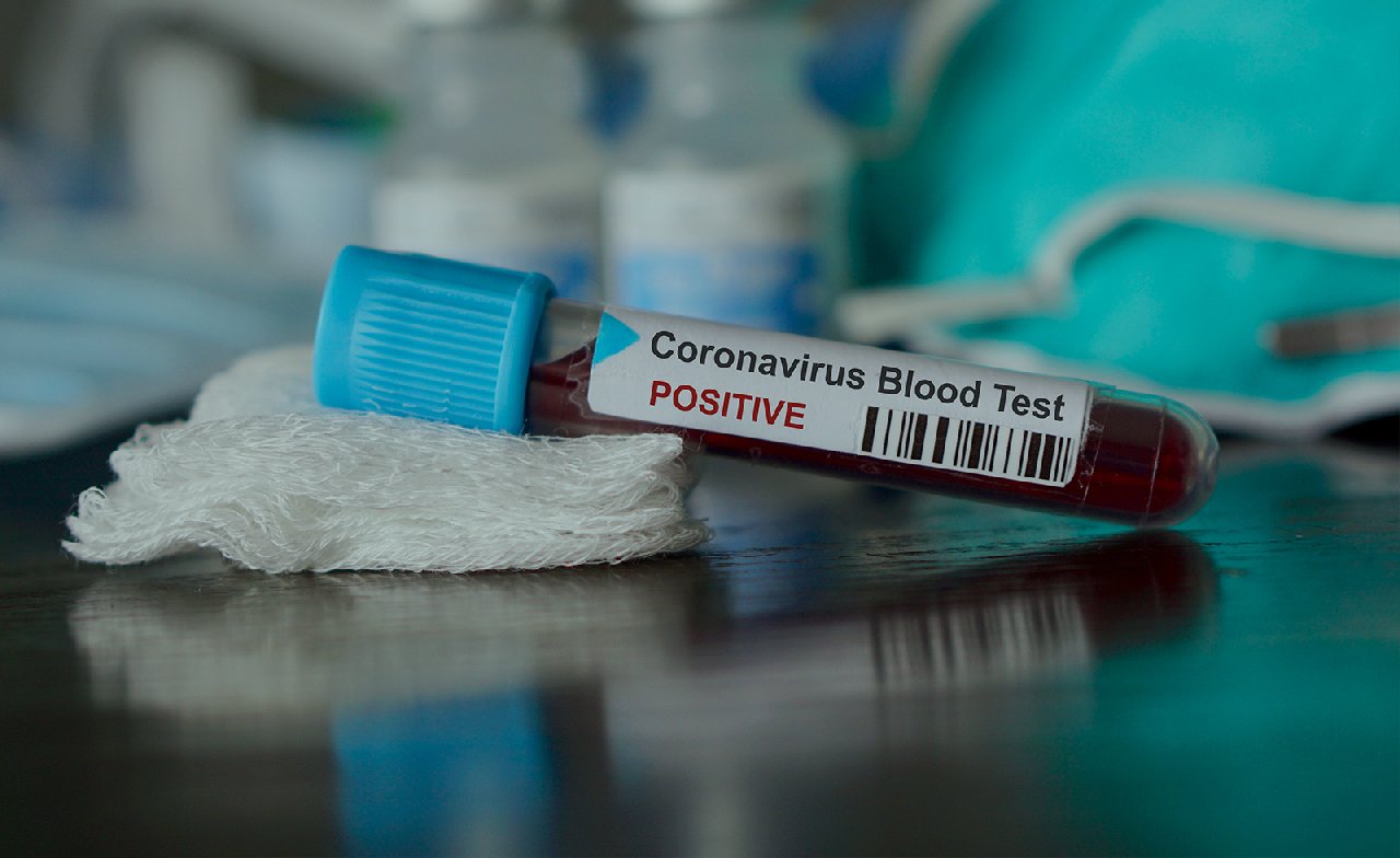 Koronavirüs Güncesi - 1