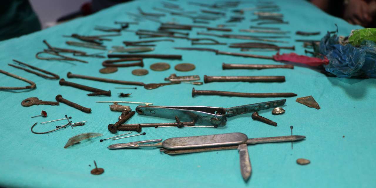 Midesinden 158 parça metal çıkarıldı: Çivi, bıçak, tırnak makası...