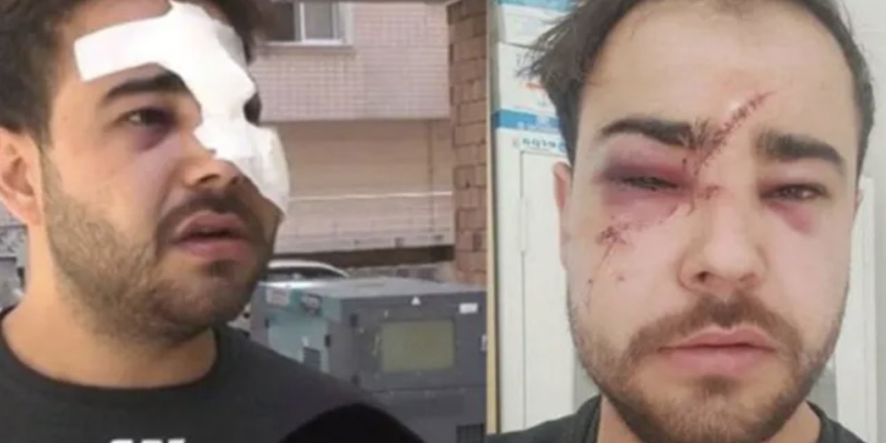 Yine 'istek şarkı' saldırısı: Müzisyenin yüzünde şişe kırdılar