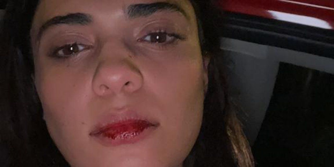 Taksi şoförü aracına çarptığı Azerbaycanlı sanatçıyı darbetti