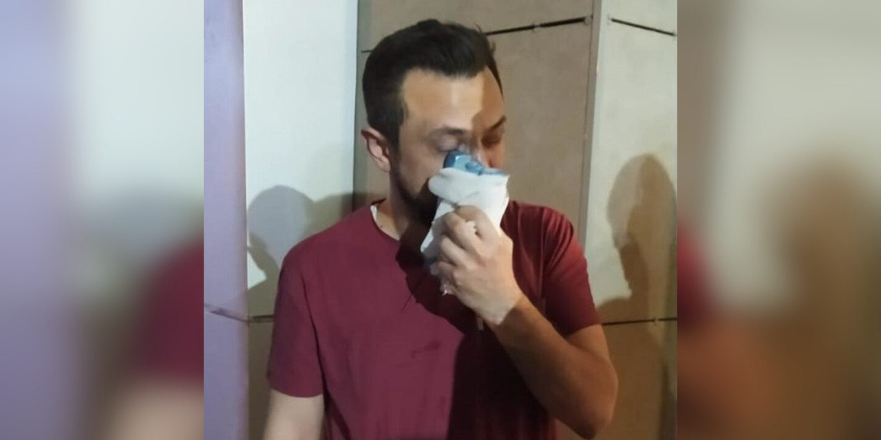 Urfa’da saldırıya uğrayan doktorun burnu kırıldı: Saldırgan gözaltında