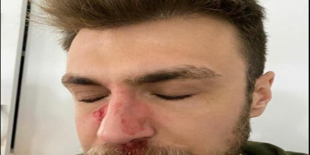 Kadın doktor isteyen hasta yakınının darp ettiği doktora kafa travması teşhisi