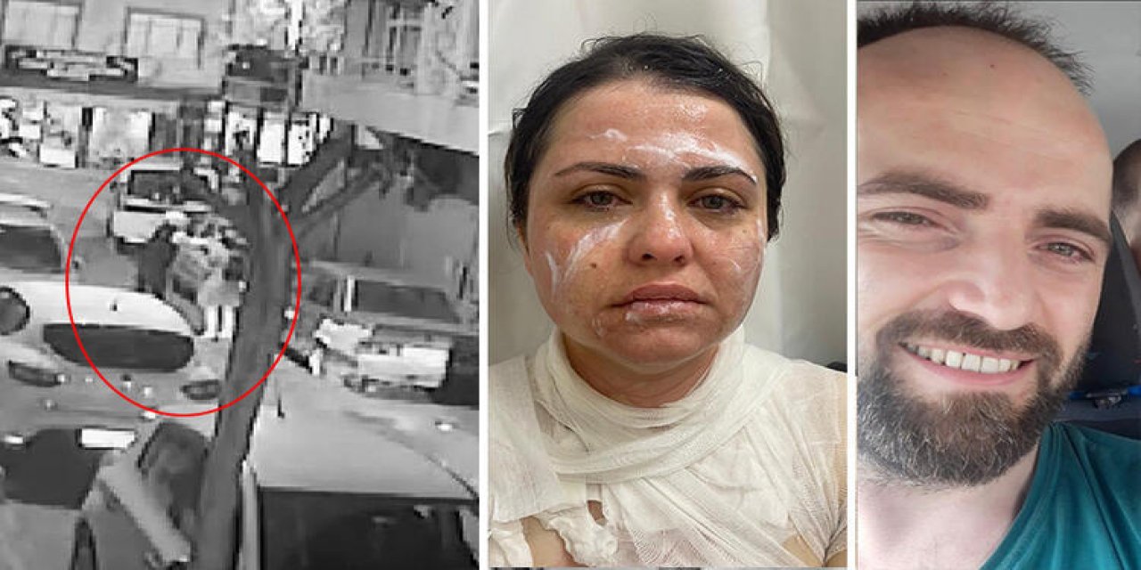 Bayrampaşa'da eski karısının yüzüne kezzap atan sanığa 5 yıl 6 ay hapis cezası