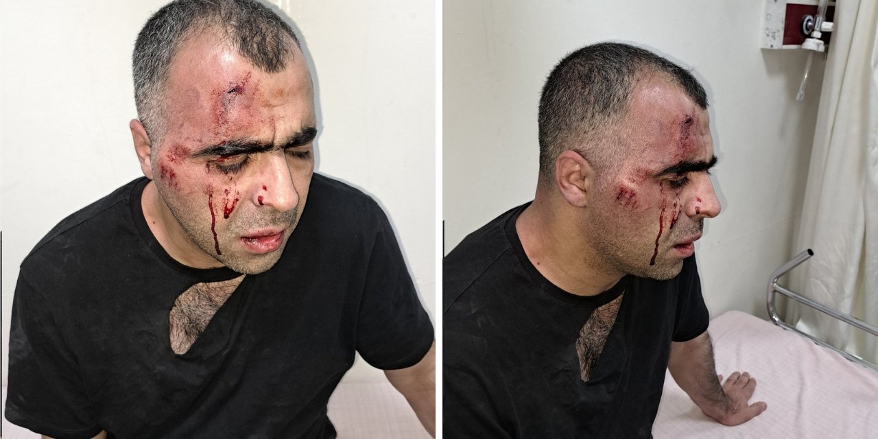 Gazeteciye traji-komik suçlama: Kendisini dövenlere ‘hakaret’ ettiği için dava açıldı