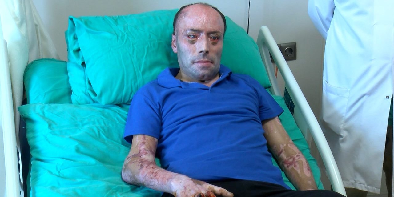 Bartın'daki maden faciasında yaralanan işçi sekiz ay sonra tabucu: 140 ameliyat gördü