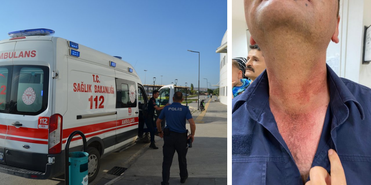 Aksaray'da kendisini geç fark eden ambulansın şoförünü darp etti