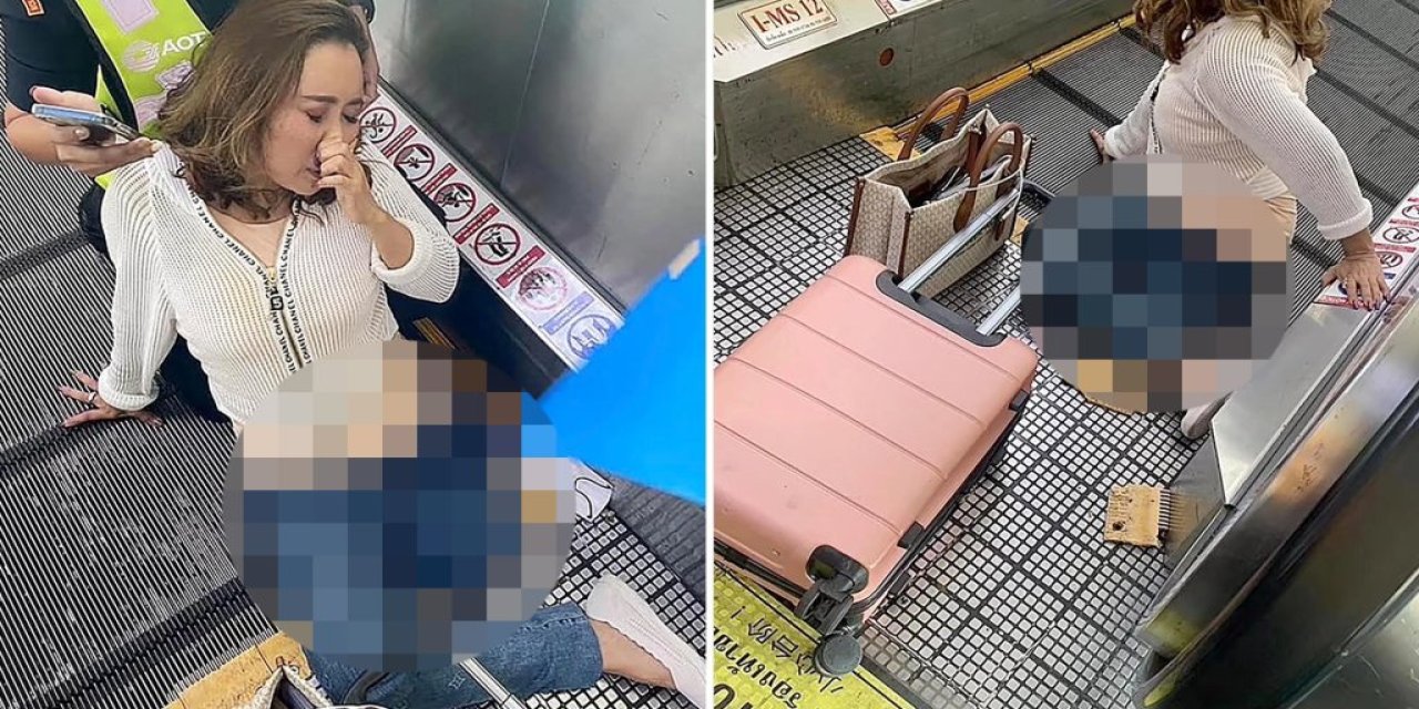 Havalimanındaki yürüyen banda sıkışan kadının bacağı kesildi
