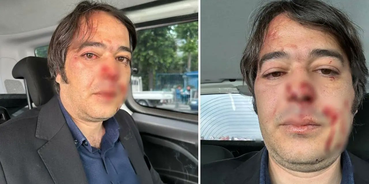 Üsküdar'da kafe yıkımı sırasında imar şube müdürüne saldıran sanığa 10 yıl 9 ay hapis talebi