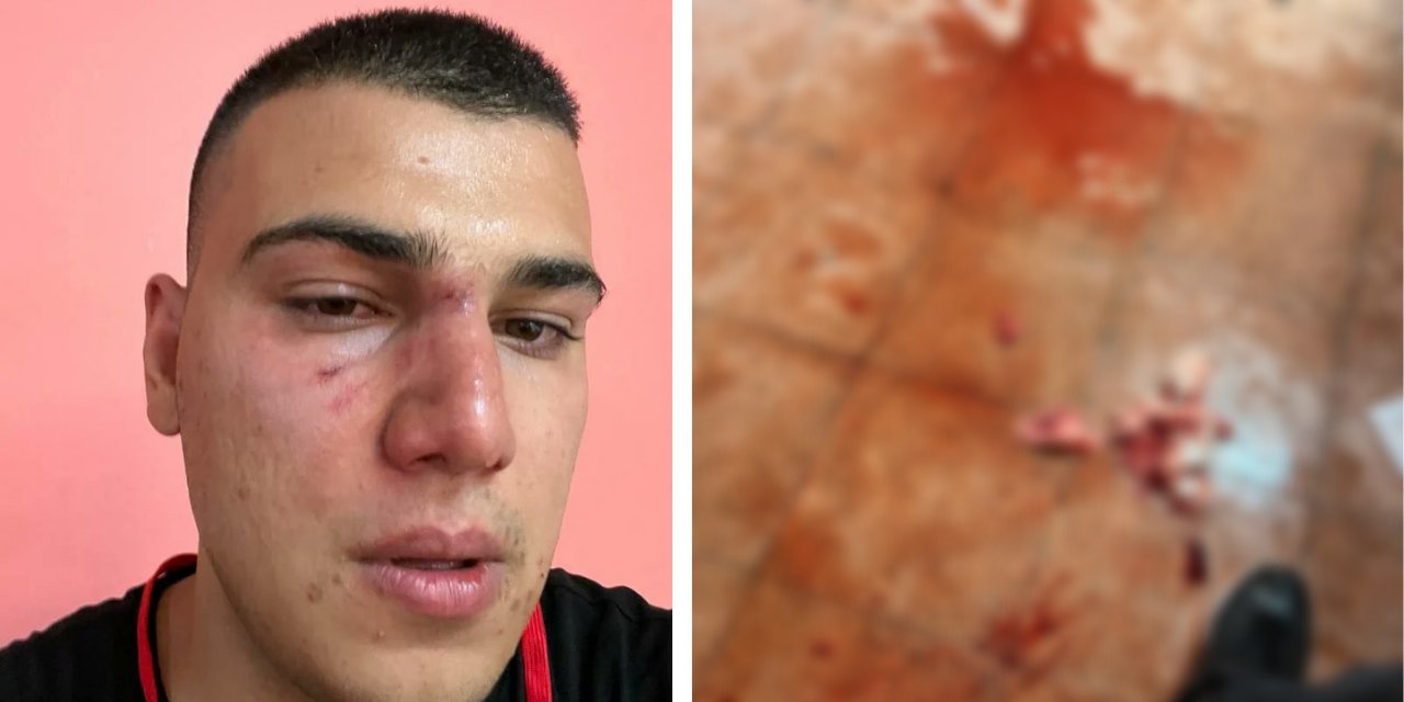 Delege seçiminde liste çıkaran CHP’li gençlere 'boksör' saldırısı