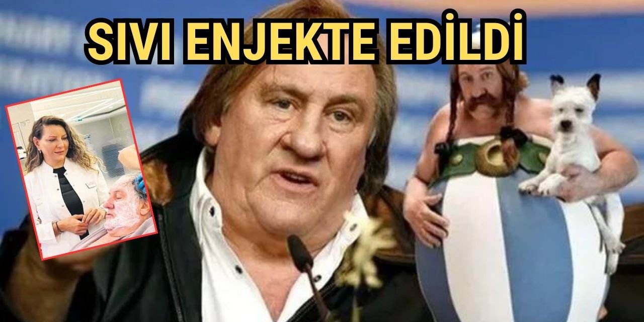 Gerard Depardieu İstanbul'da estetik operasyon geçirdi: Sıvı enjekte edildi