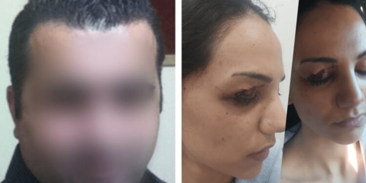 Polis eşine emniyette çıplak arama ve işkence iddiası