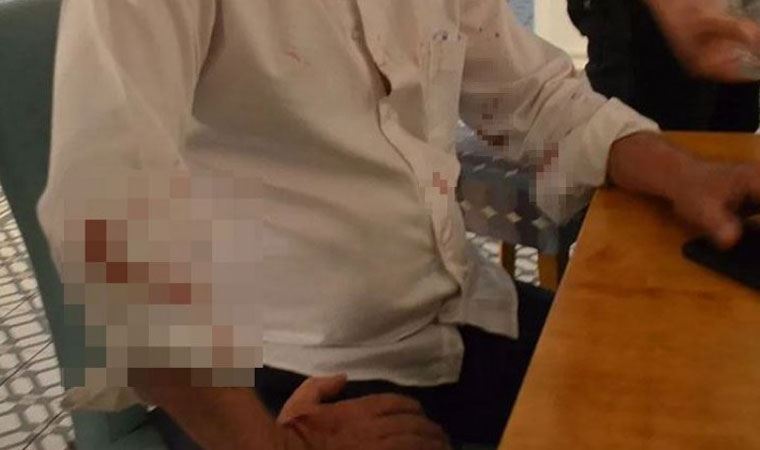 Didim Belediye Başkanı Atabay'a saldıranlar serbest bırakıldı