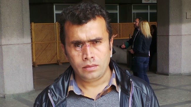 Gezi'de gözünü kaybeden Muharrem Dalsüren’e 100 bin TL tazminat