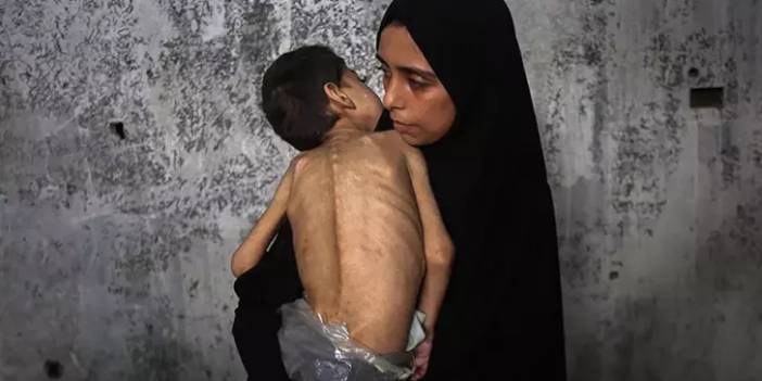 Gazze'de 5 aylık bebek açlıktan öldü