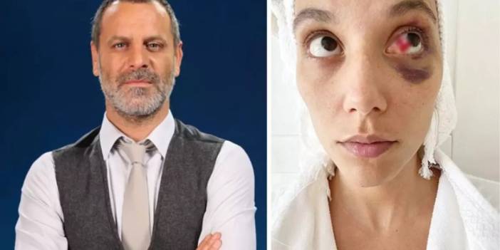 Ozan Güven’in kadına şiddet cezası onandı: 45 gün cezaevinde kalacak