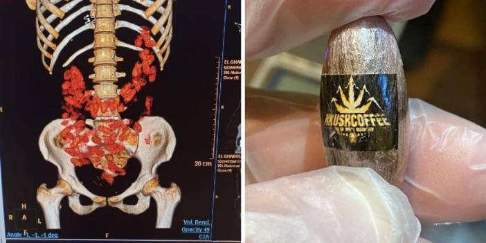 Kadınların midesindeki kapsülden Urfi Çetinkaya'nın kardeşi ve yeğeni çıktı