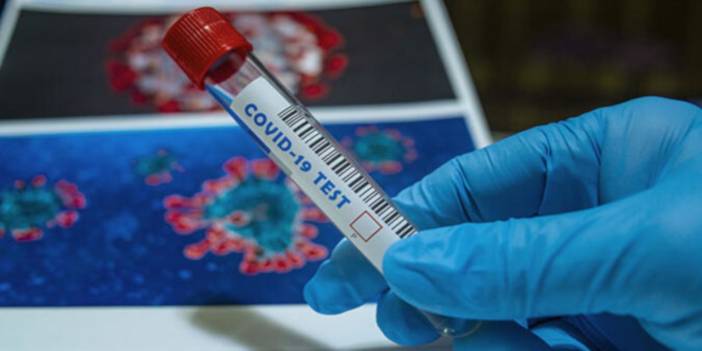 TTB anketinden çıkan sonuç: Günde 16 bin korona vakası var