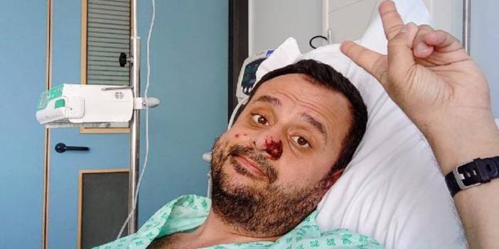 Harun Tulunay maymun çiçeğini anlattı: En korkutucu üç virüsü yendi, damgalamayı yenemedi