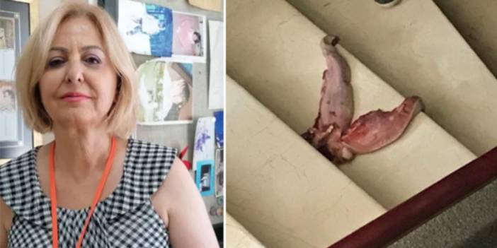 Prof. Dr. Esin Davutoğlu Şenol cinayet girişiminin ayrıntılarını anlattı