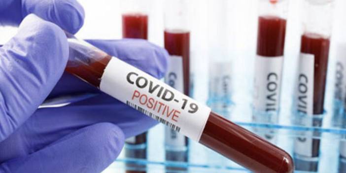 İtalya'da Covid19 soruşturması: Eski Başbakan ve Sağlık Bakanı da şüpheli