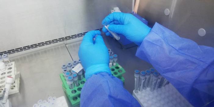 ABD Enerji Bakanlığı’ndan yeni rapor: Covid-19 laboratuvardan mı sızdı?