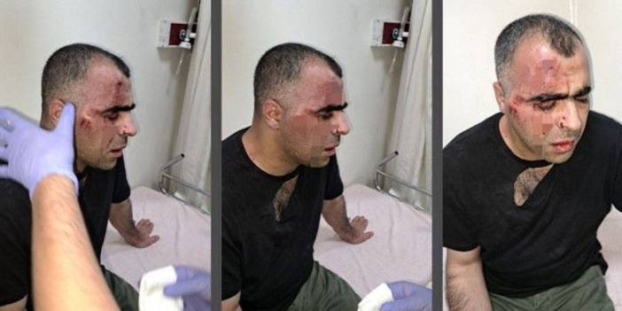 Gazeteci Sinan Aygül’e saldıranlar hakkında tahliye kararı
