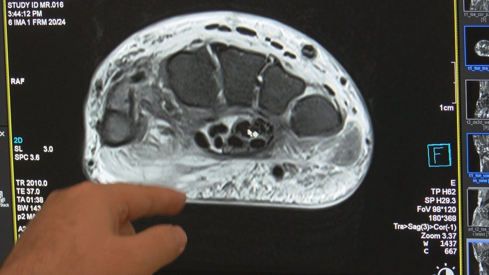 Aşırı cep telefonu kullanımı kireçlenme vakalarında artışa neden olacak